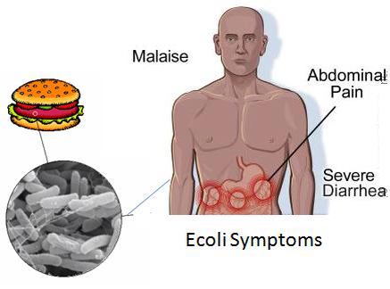 E Coli Ways To Avoid And Reduce Foodborneillnesses